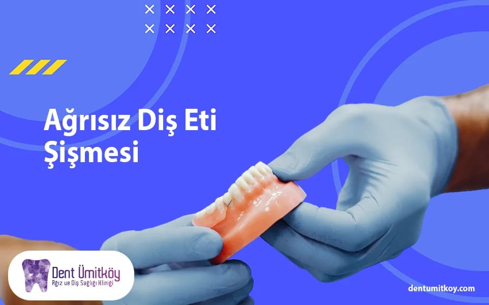 Painless Gum Swelling