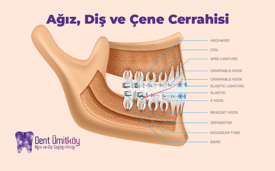 Ankara Ağız, Diş ve Çene Cerrahisi: Uzman Çözümler