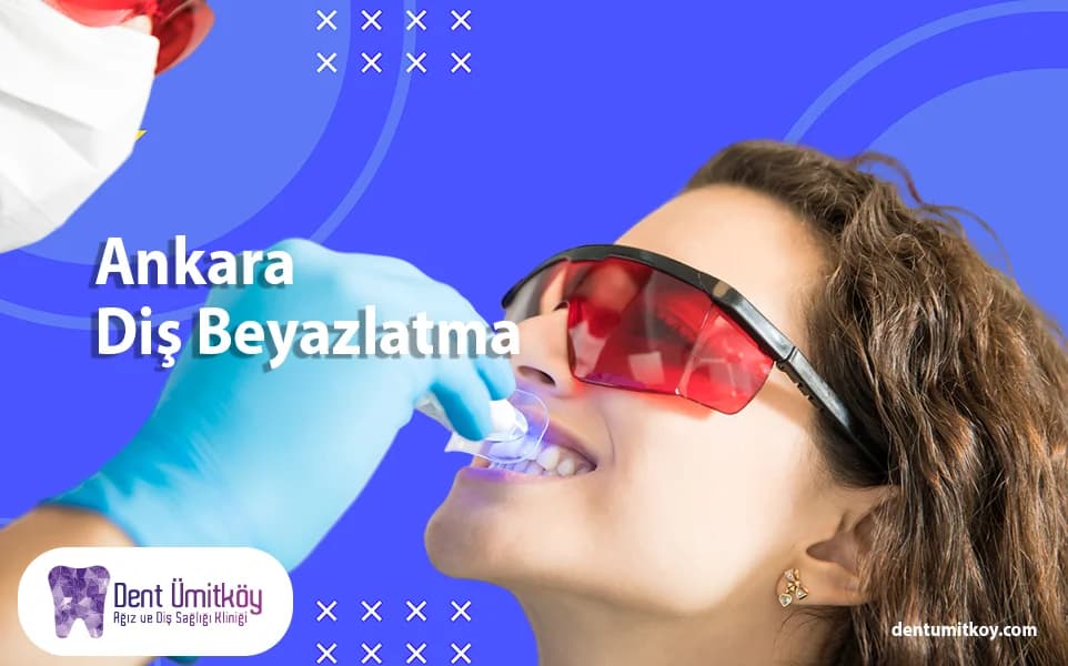 Ankara Diş Beyazlatma