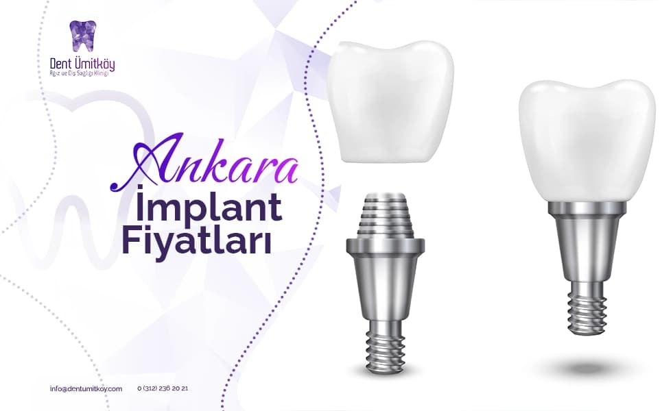 Dental Implant Costs in Ankara