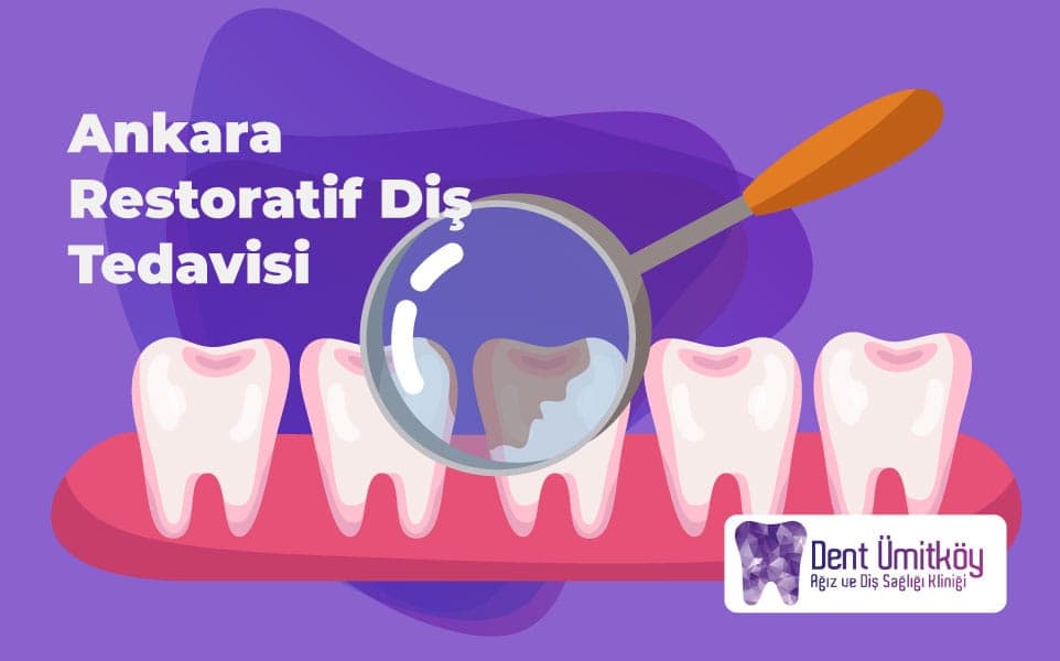 Ankara Restoratif Diş Tedavisi: Fonksiyon ve Estetiğin Yeniden İnşası