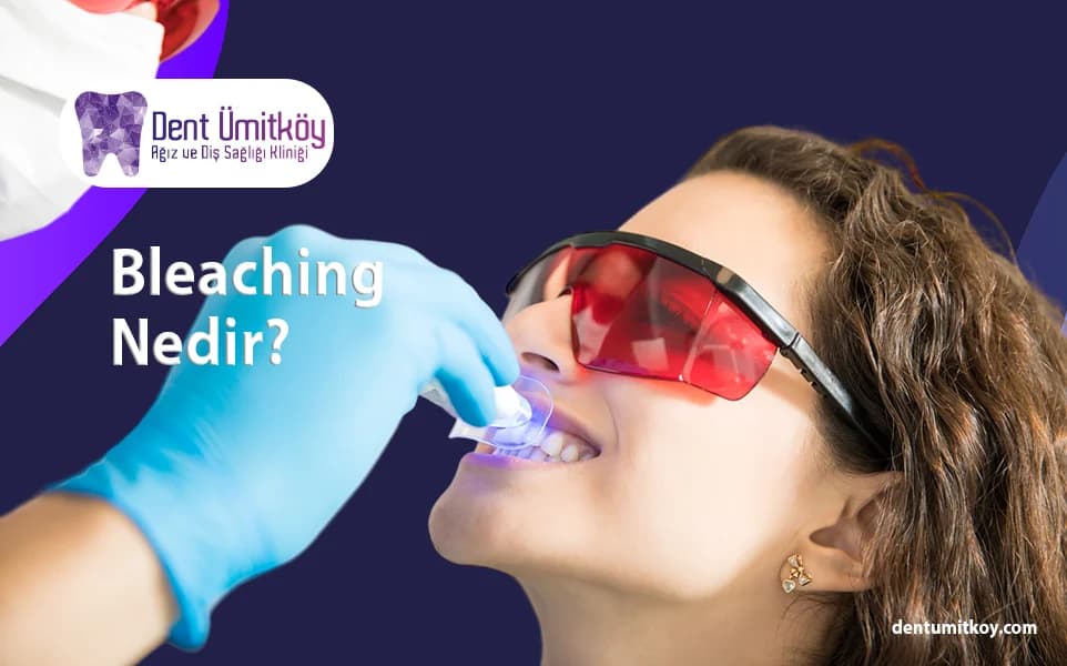 Bleaching in Ankara
