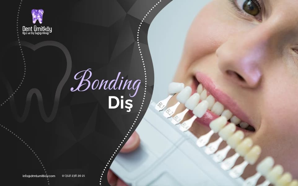 Dental Bonding