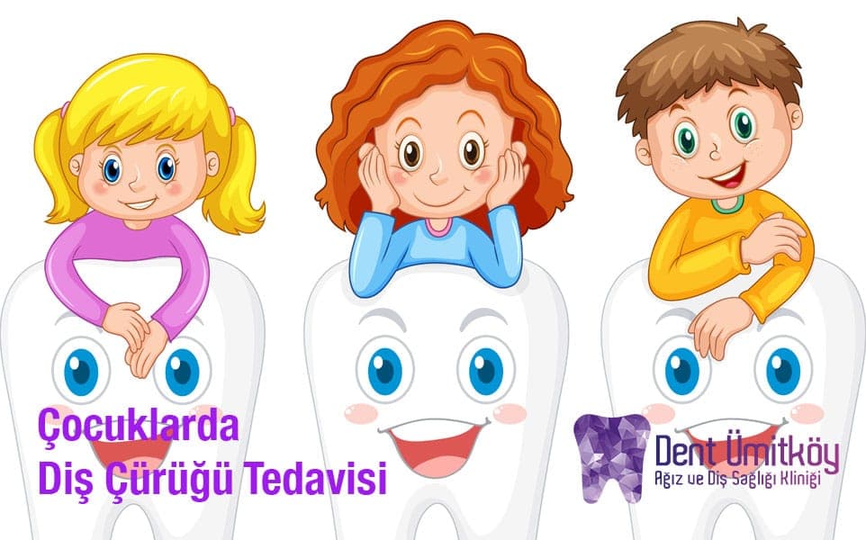Çocuklarda Diş Çürüğü Tedavisi