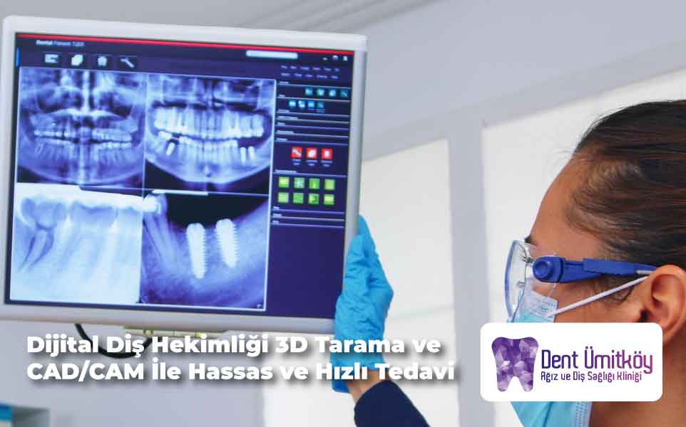 Digital Dentistry in Ankara: Precise and Fast Treatment with 3D Scanning and CAD/CAM