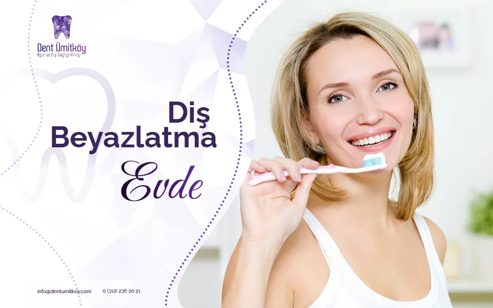 At-Home Teeth Whitening
