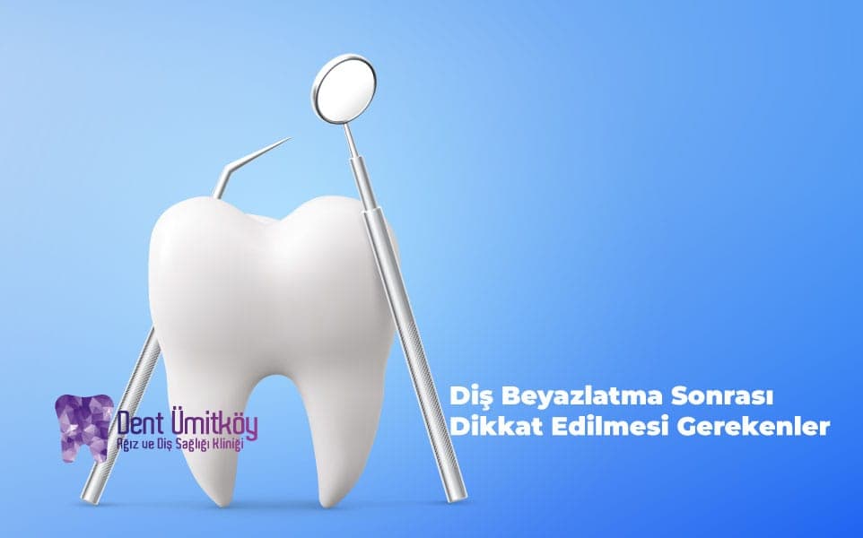 Diş Beyazlatma Sonrası Dikkat Edilmesi Gerekenler: Adım Adım Bakım Rehberi