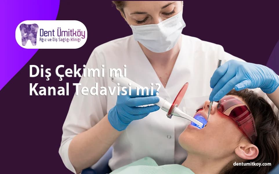 Tooth Extraction or Root Canal? Which Treatment Should You Choose?