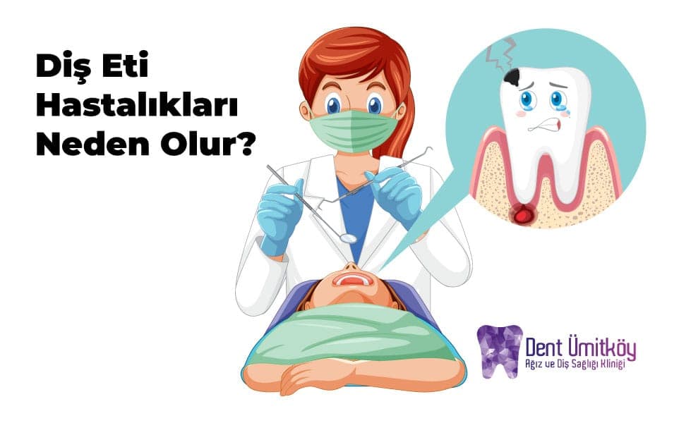 What Causes Gum Disease? The Hidden Triggers