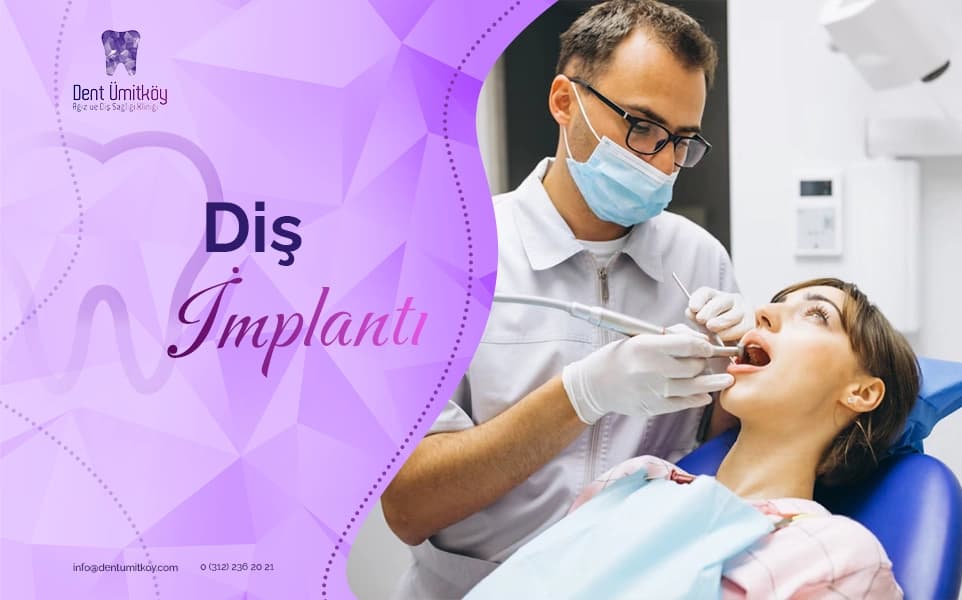 Diş İmplantı Nasıl Yapılır?