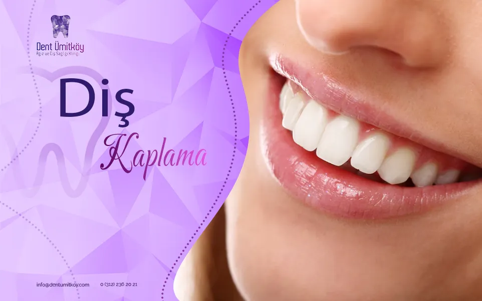 Dental Crowns