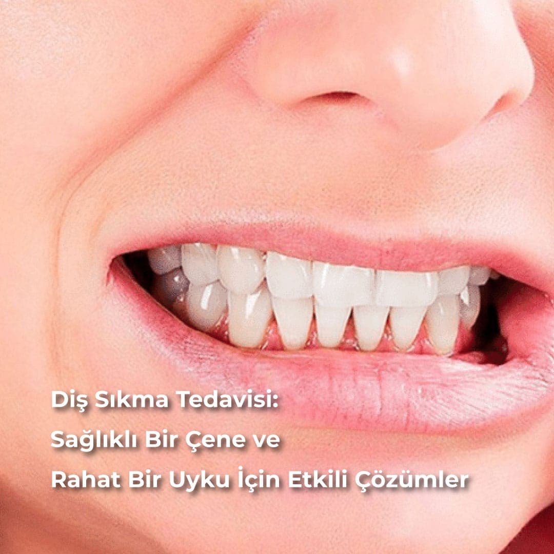 Diş Sıkma Tedavisi