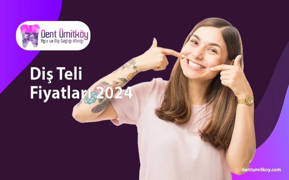 Diş Teli Fiyatları 2024