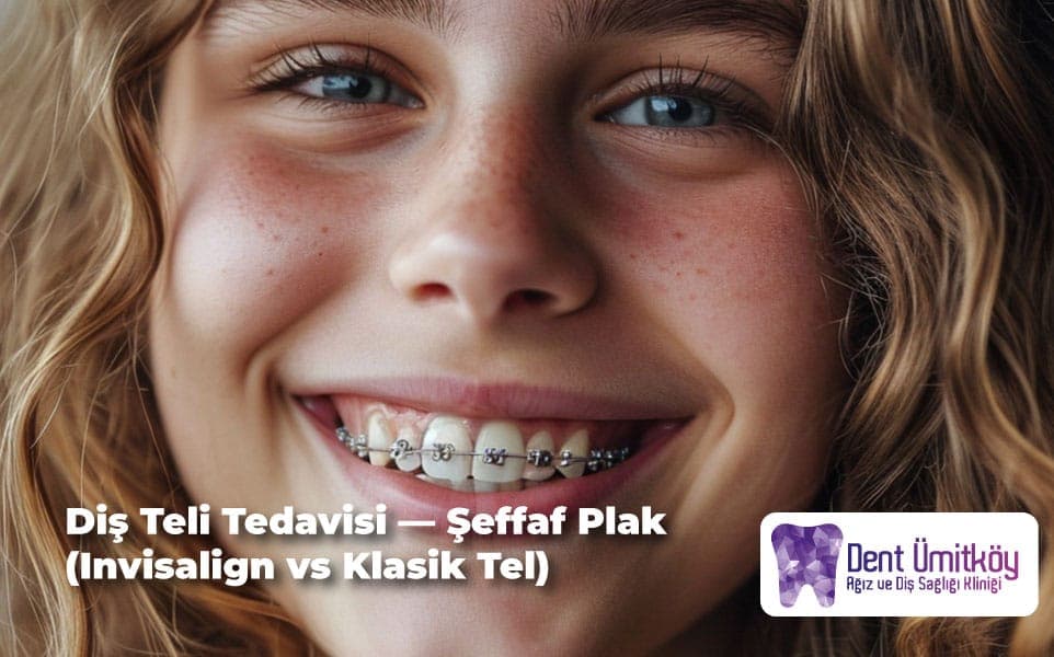 Diş Teli Tedavisi ve Şeffaf Plak