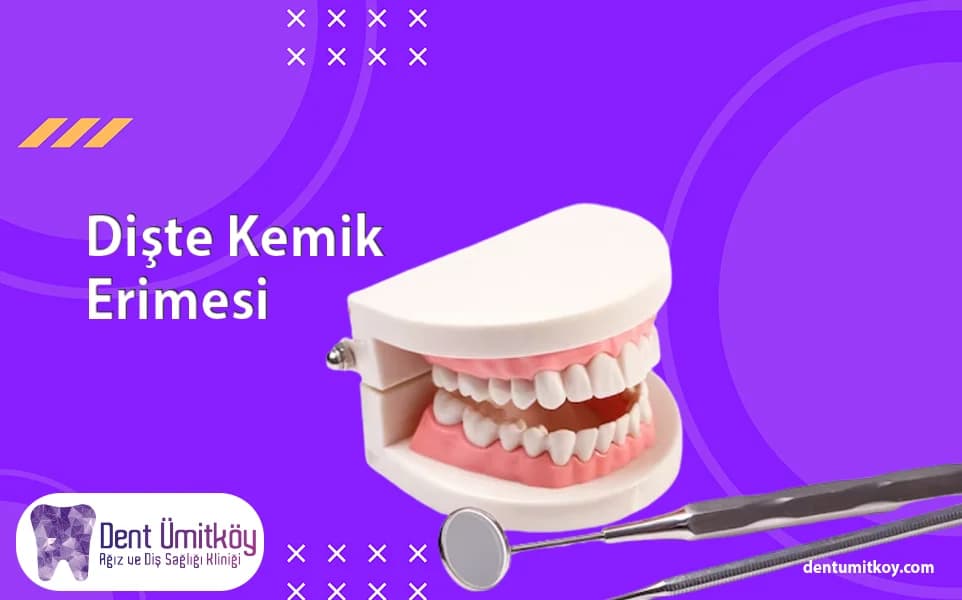 Dişte Kemik Erimesi