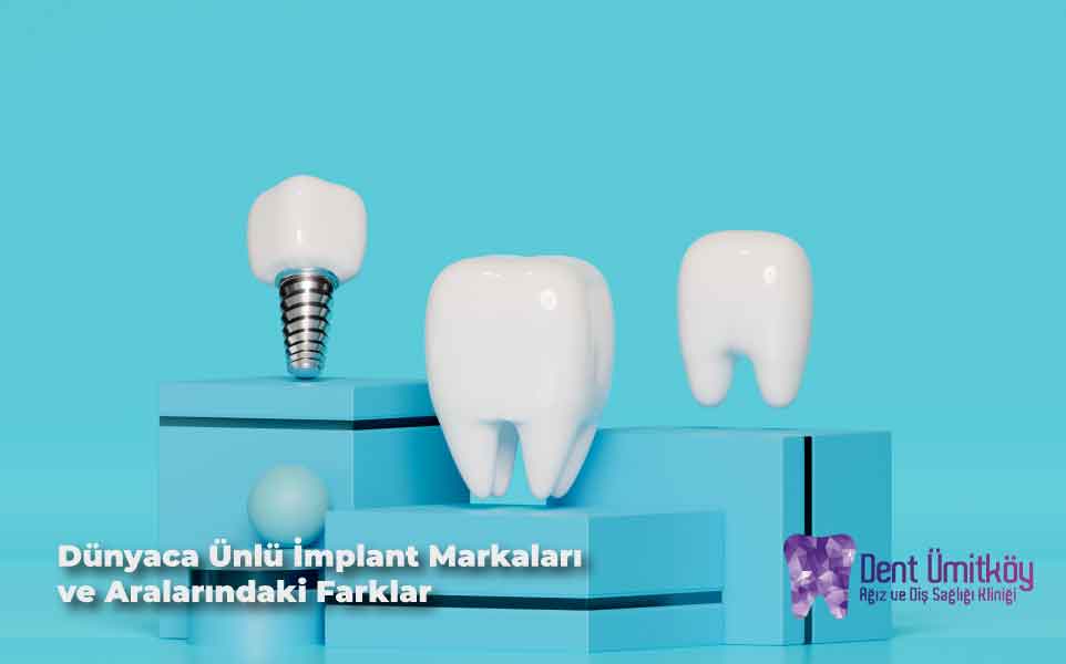 Dünyaca Ünlü İmplant Markaları ve Aralarındaki Farklar