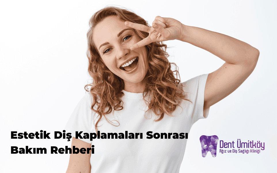 Care Guide After Cosmetic Dental Veneers: Protect Your Smile for Life