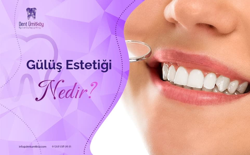 What Is Smile Design?