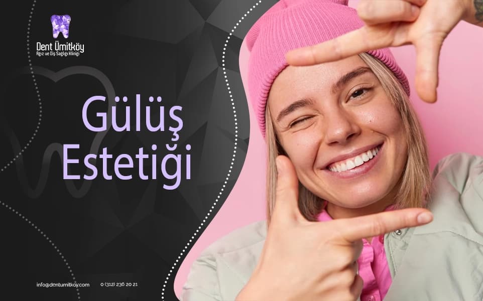 Smile Design