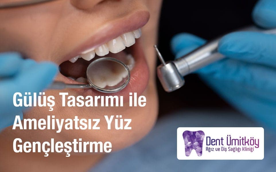 Gülüş Tasarımı ile Ameliyatsız Yüz Gençleştirme