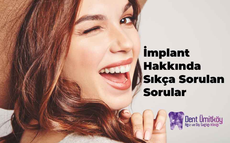 İmplant Hakkında Sıkça Sorulan Sorular: Ankara İmplant Rehberi 2026