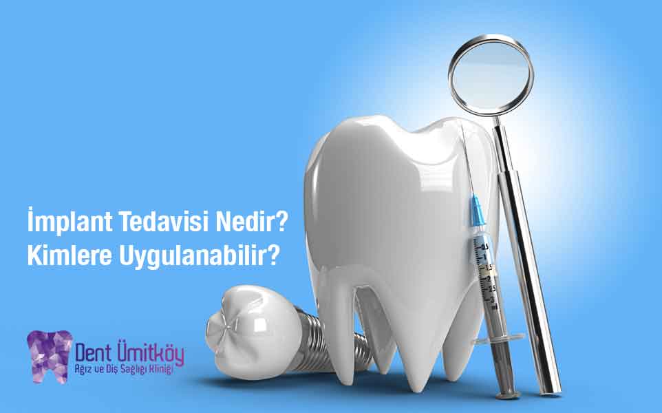 İmplant Tedavisi Nedir? Kimlere Uygulanabilir?