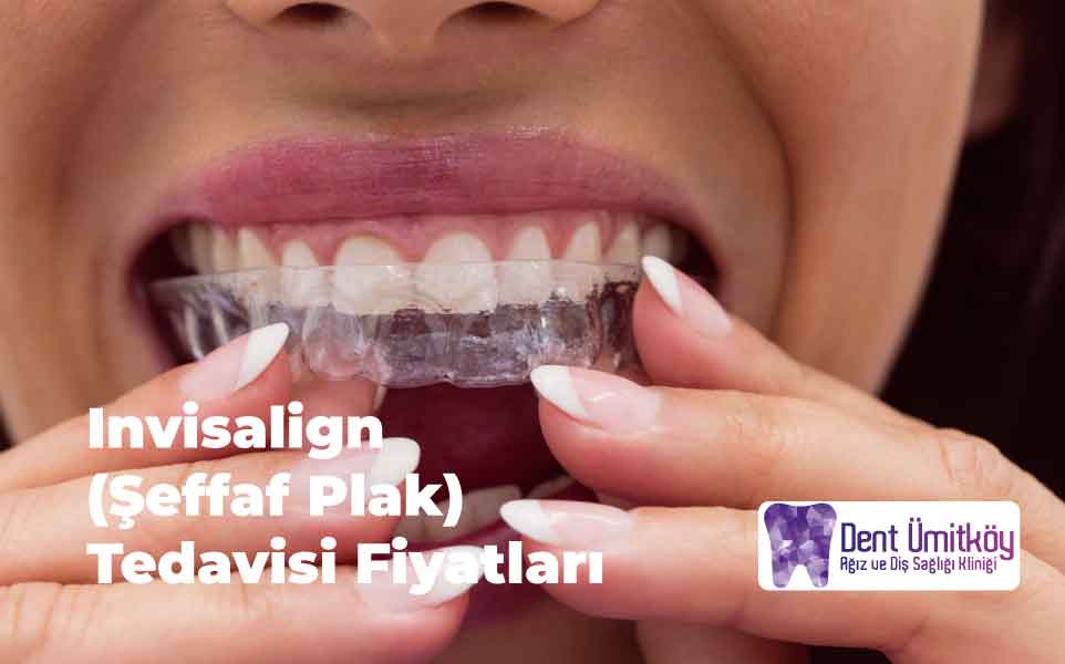 Invisalign Şeffaf Plak Tedavisi Fiyatları 2026: Maliyeti Belirleyen Faktörler