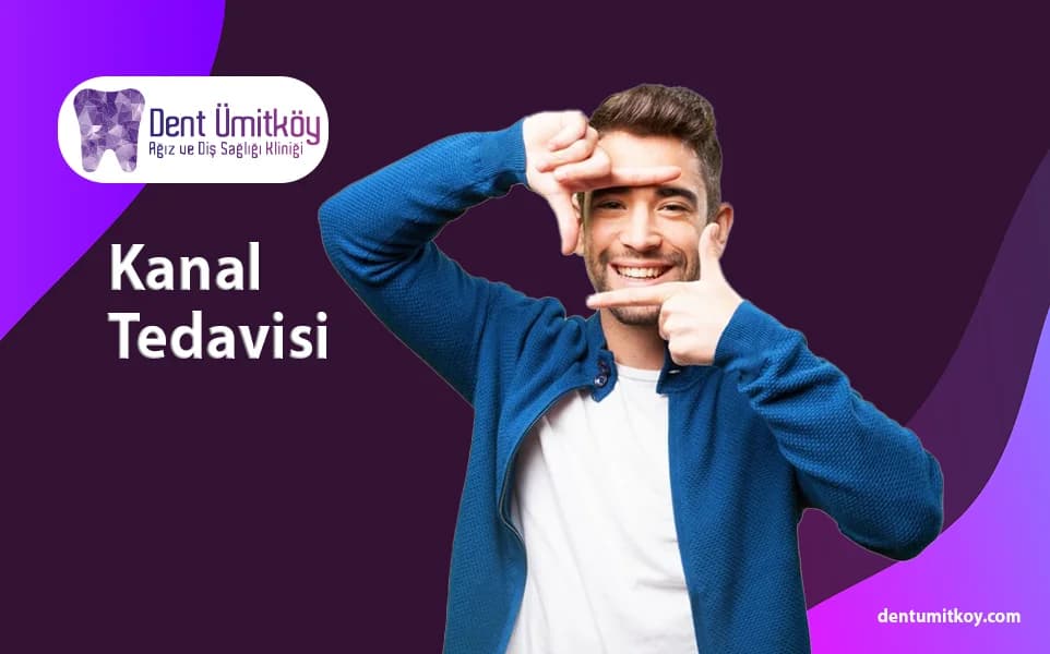 Root Canal Treatment