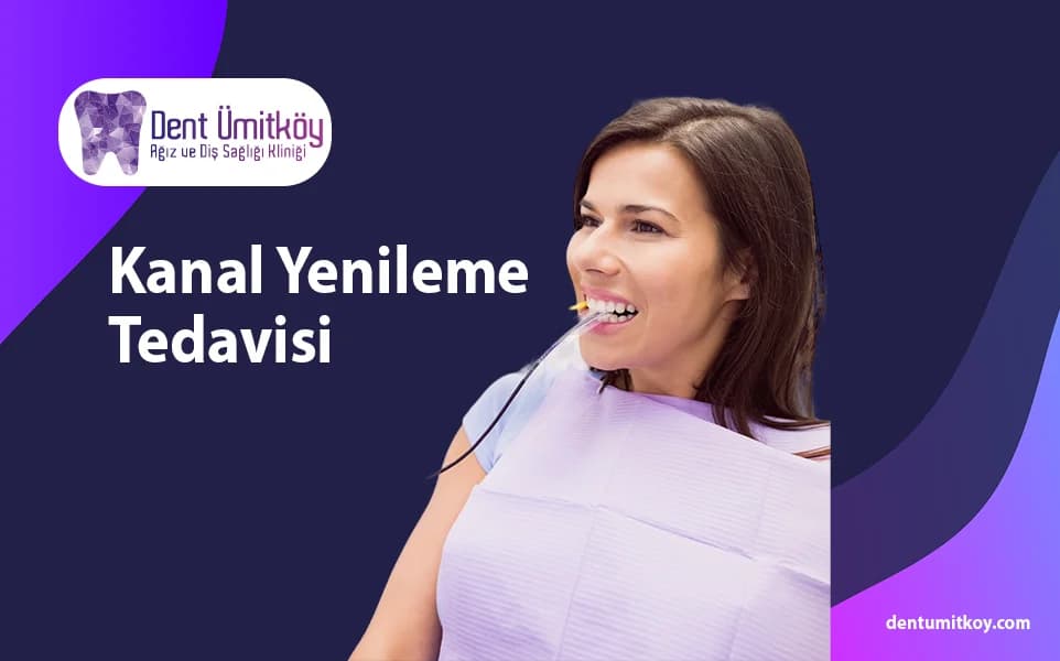 Kanal Yenileme Tedavisi