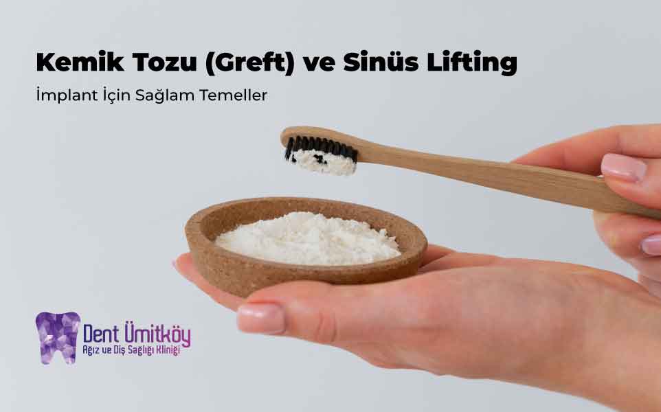Bone Graft and Sinus Lifting: Solid Foundations for Implants