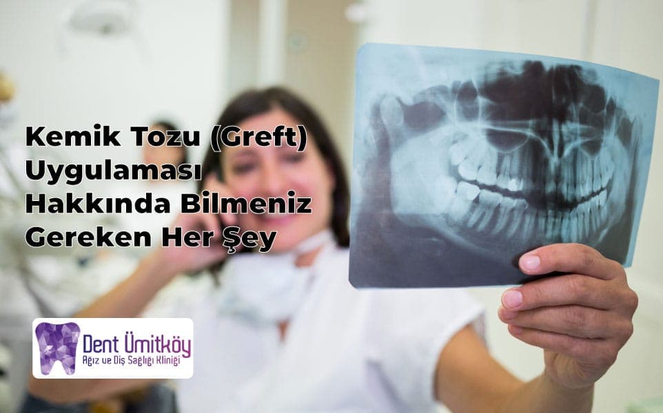 Kemik Tozu Uygulaması Hakkında Bilmeniz Gereken Her Şey