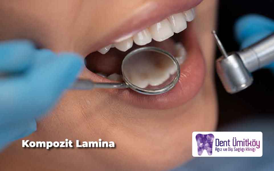 Kompozit Lamina