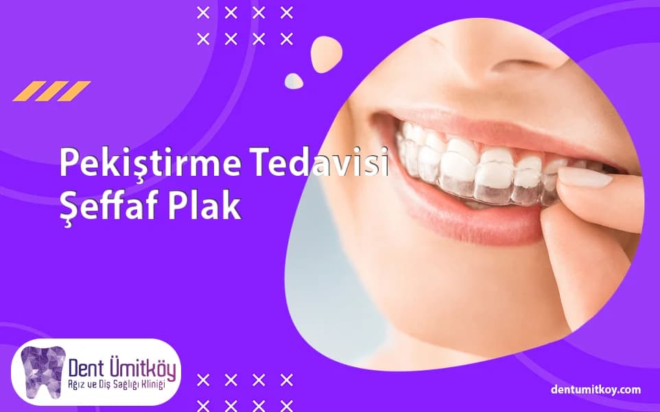 Retention Treatment with Clear Retainers - What Is Retention Treatment?