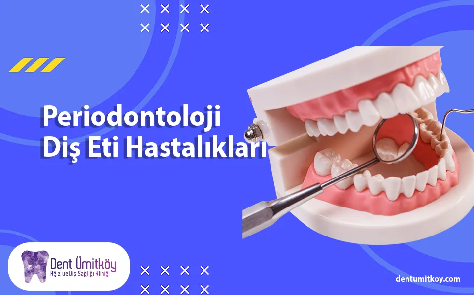Periodontoloji Diş Eti Hastalıkları - En Çok Görülen Diş Hastalığı