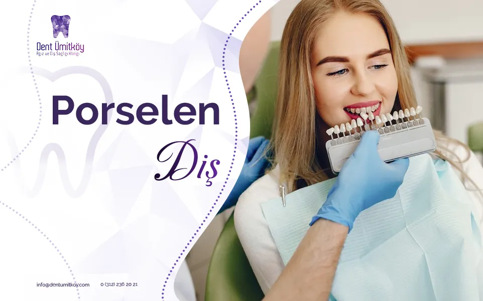 Porselen Diş - Porselen Diş Nedir? Nasıl Yapılır?