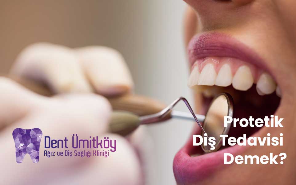 Protetik Diş Tedavisi Ne Demek?