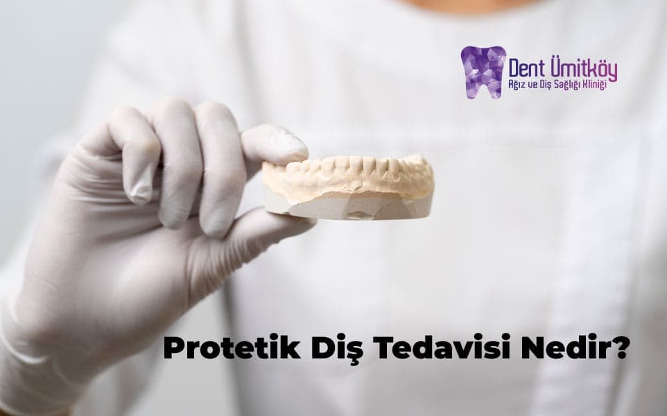What Is Prosthetic Dental Treatment? Artfully Restoring a Lost Smile