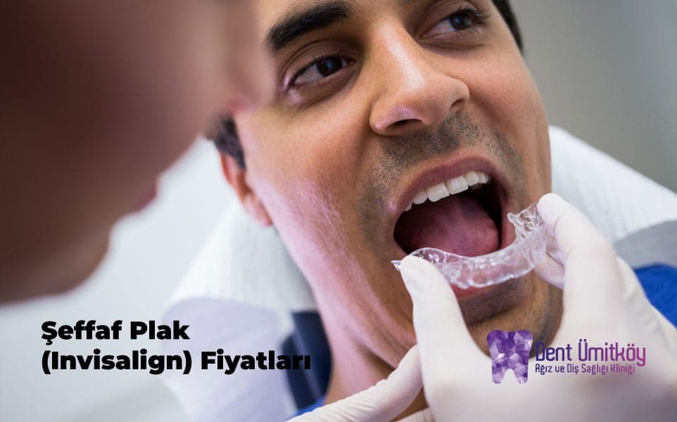 Şeffaf Plak (Invisalign) Fiyatları: 2026 Maliyet Rehberi