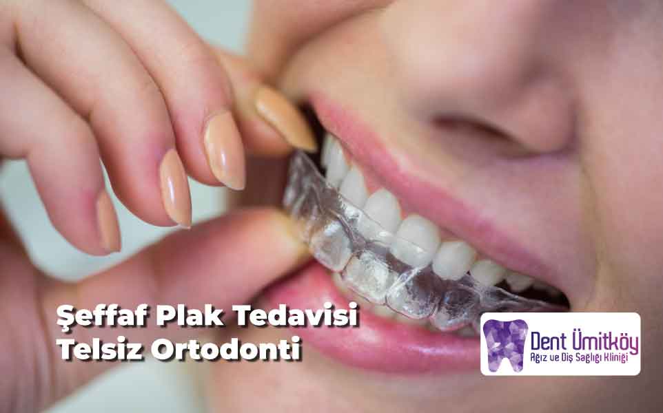 Şeffaf Plak Tedavisi (Telsiz Ortodonti) Ankara