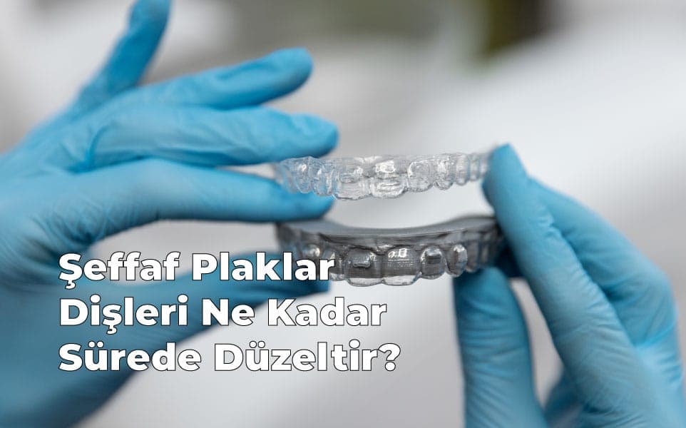 Şeffaf Plaklar Dişleri Ne Kadar Sürede Düzeltir?