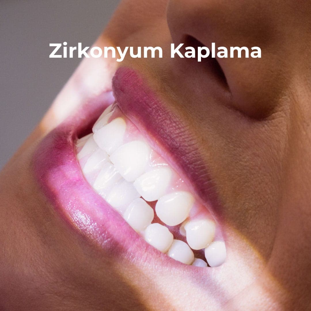 Zirkonyum Kaplama: Estetik ve Dayanıklı Dişler İçin Modern Çözüm