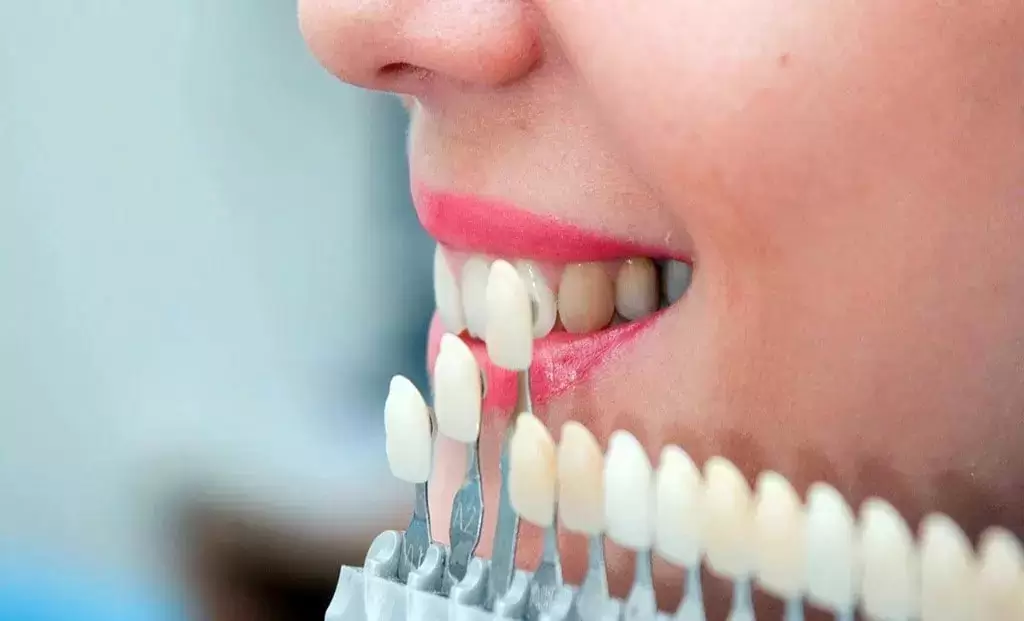 Are Patients Satisfied with Zirconia Crowns?
