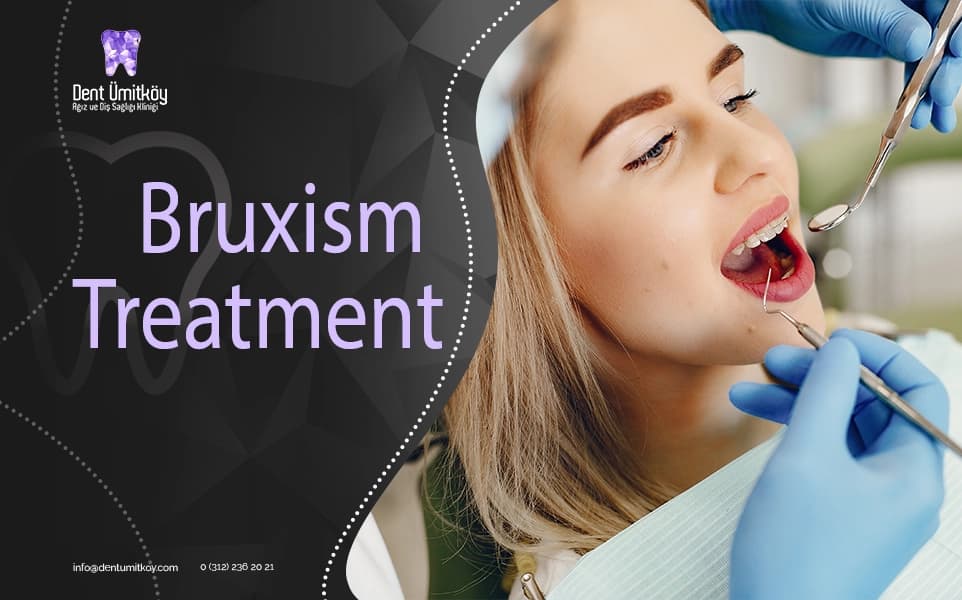 Bruxism Treatment