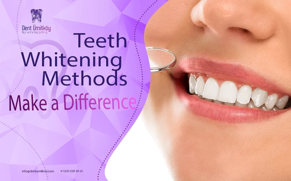 Teeth Whitening Methods