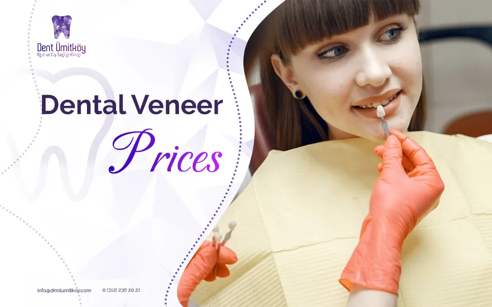 Dental Veneer Prices