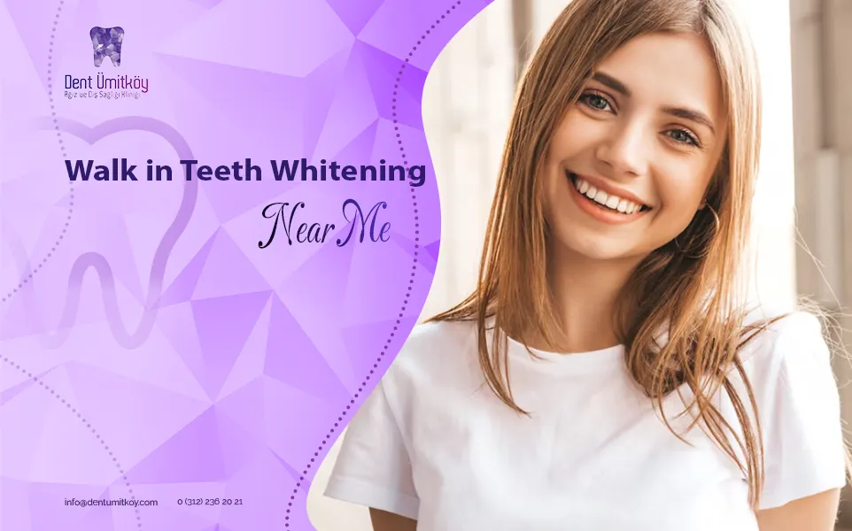 Walk in Teeth Whitening Near Me