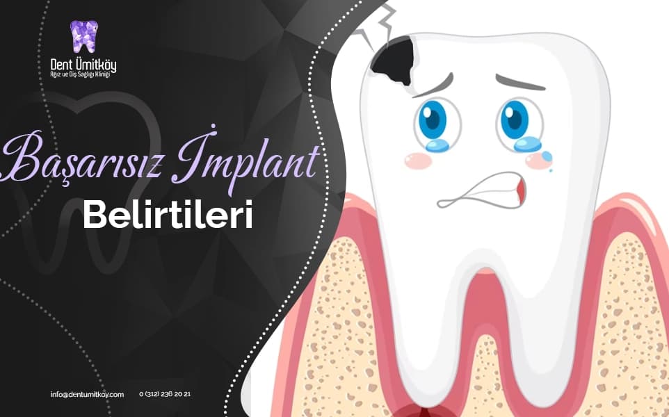 Başarısız İmplant Belirtileri