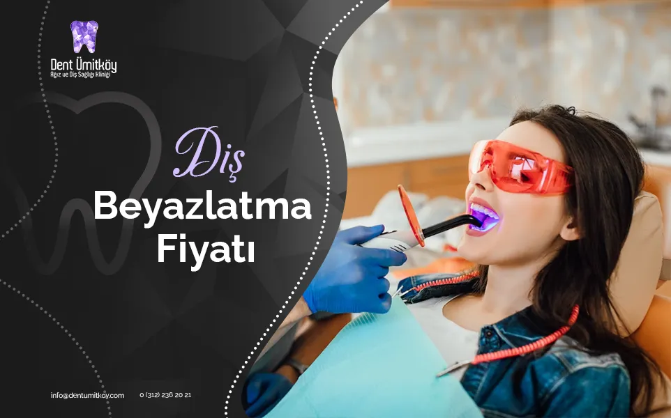 Diş Beyazlatma Fiyatını Belirleyen Faktörler