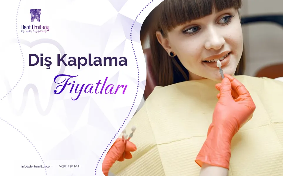 Diş Kaplama Fiyatları