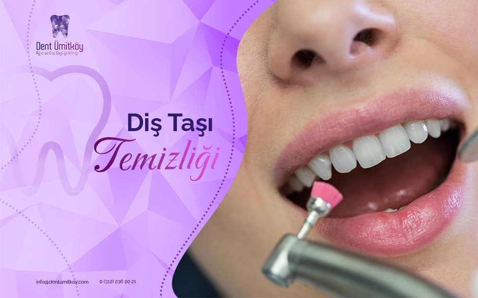Dental Tartar Cleaning